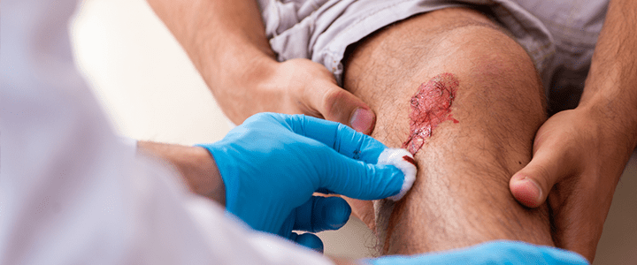 First Aid in the Workplace - Knee Injury